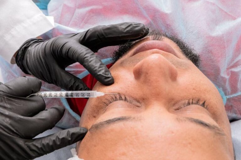 Mengapa Skincare Tidak Efektif untuk Menghilangkan Bopeng?