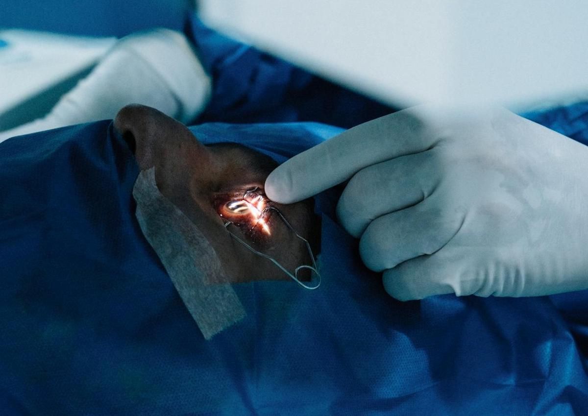 Usia Ideal dan Kondisi Aman untuk Operasi LASIK